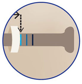 Integrated pressure adjuster system on lower limb (calf and thigh)