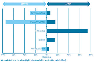 Before & after chart