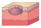 Figure 3c