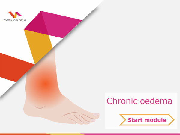 Chronic oedema e-learning module