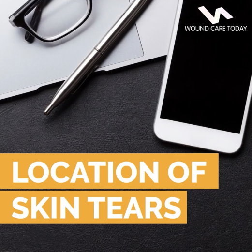 Instalearn - Location of skin tears