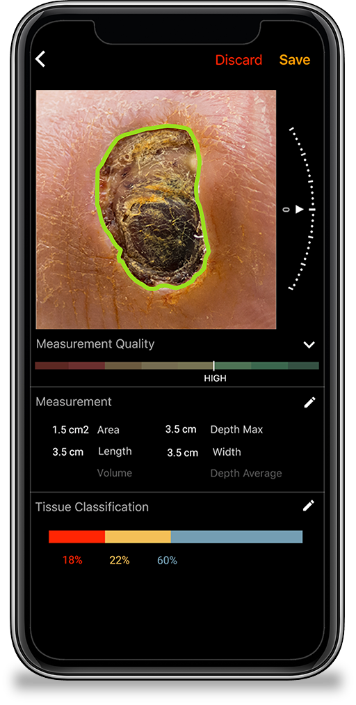 eKare inSight<sup>®</sup>