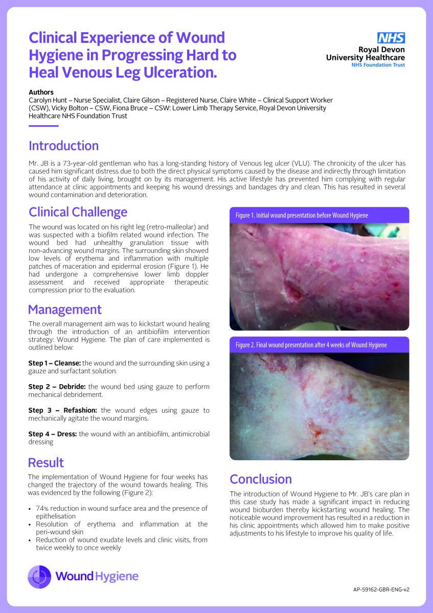 Clinical Experience of Wound Hygiene in Progressing Hard to Heal Venous Leg Ulceration.