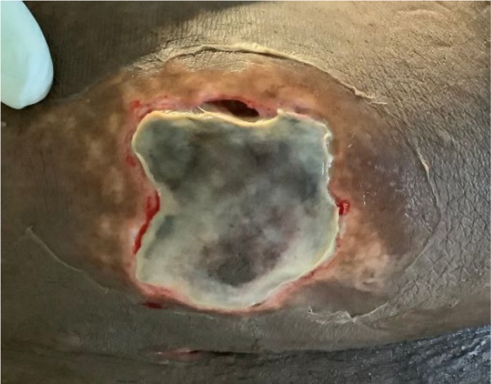 Case study 2: before